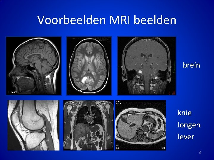 Voorbeelden MRI beelden • • • f brein f knie longen lever f f