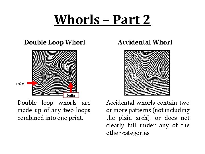 Whorls – Part 2 Double Loop Whorl Accidental Whorl Delta Double loop whorls are