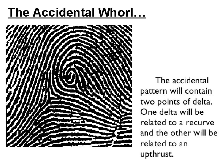 The Accidental Whorl… 