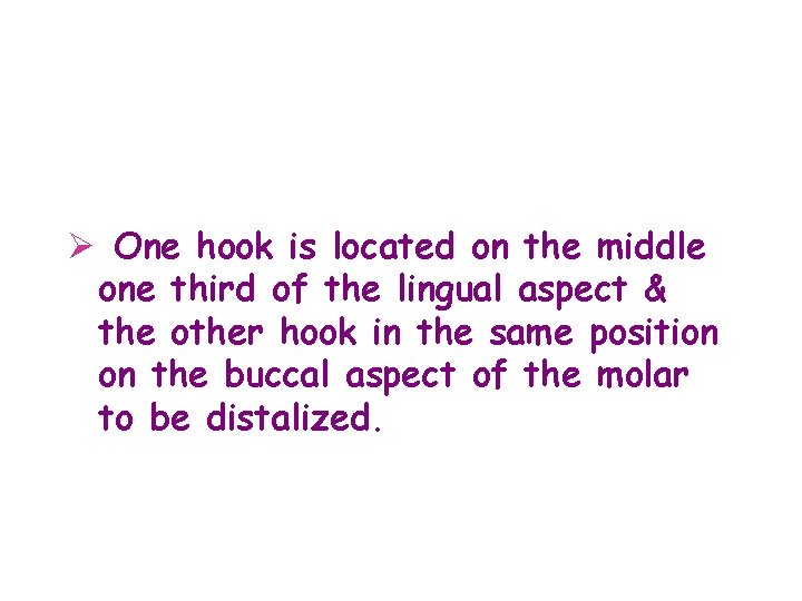 Ø One hook is located on the middle one third of the lingual aspect