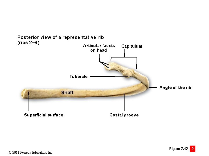 Posterior view of a representative rib (ribs 2– 9) Articular facets on head Capitulum