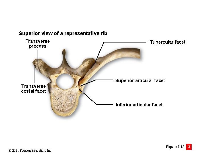 Superior view of a representative rib Transverse process Tubercular facet Superior articular facet Transverse