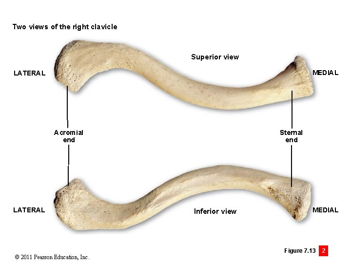 Two views of the right clavicle Superior view MEDIAL LATERAL Acromial end LATERAL ©