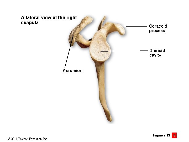 A lateral view of the right scapula Coracoid process Glenoid cavity Acromion © 2011