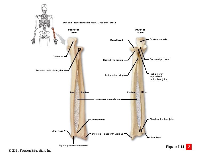 Surface features of the right ulna and radius Posterior view Anterior view Trochlear notch