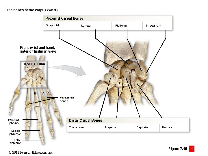 The bones of the carpus (wrist) Proximal Carpal Bones Scaphoid Lunate Pisiform Triquetrum Right