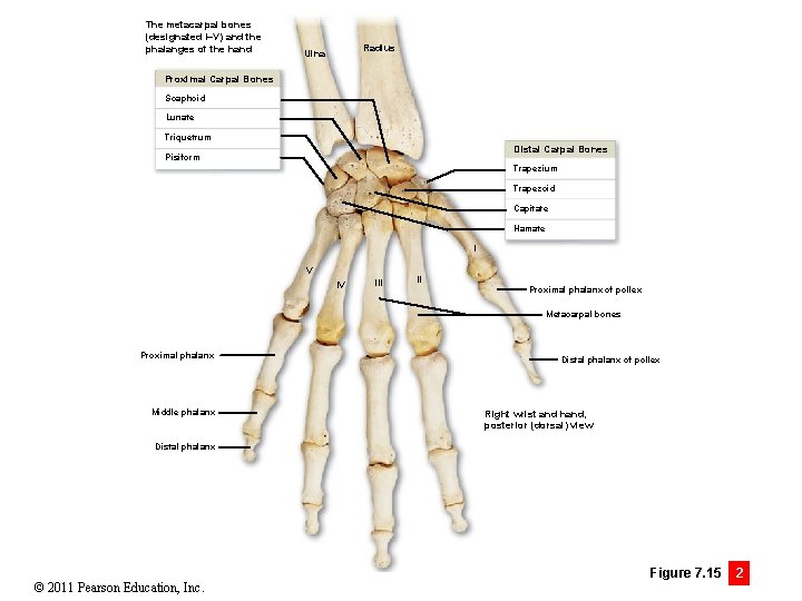The metacarpal bones (designated I–V) and the phalanges of the hand Radius Ulna Proximal