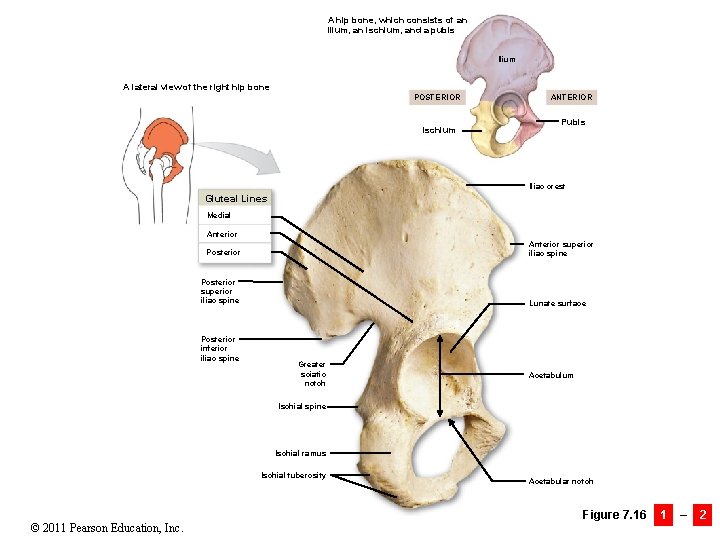A hip bone, which consists of an ilium, an ischium, and a pubis Ilium
