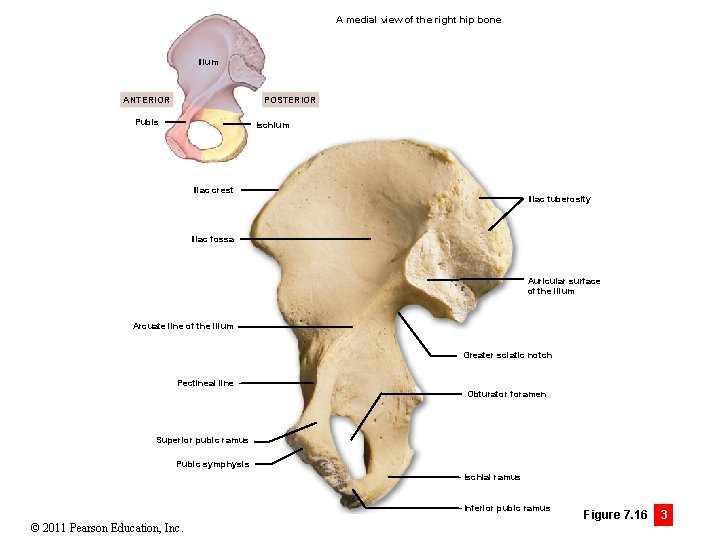 A medial view of the right hip bone Ilium ANTERIOR POSTERIOR Pubis Ischium Iliac