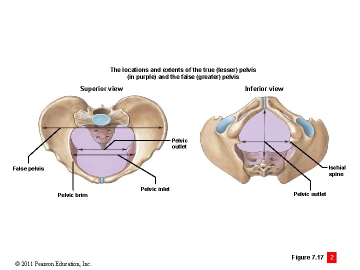 The locations and extents of the true (lesser) pelvis (in purple) and the false