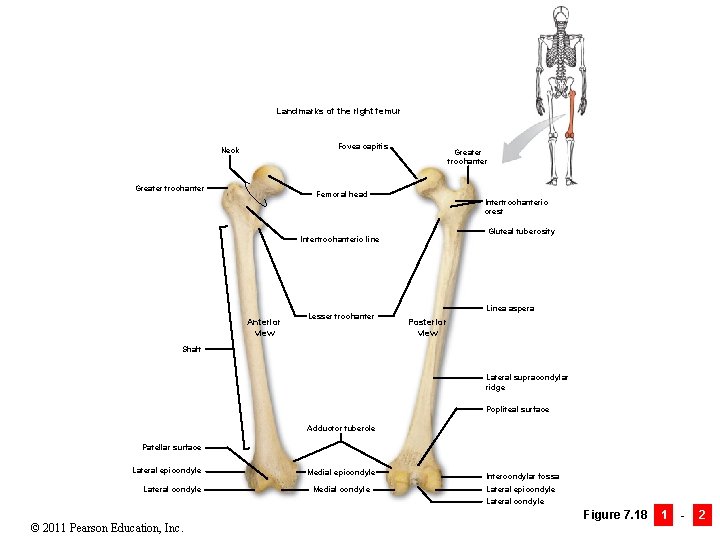 Landmarks of the right femur Fovea capitis Neck Greater trochanter Femoral head Intertrochanteric crest