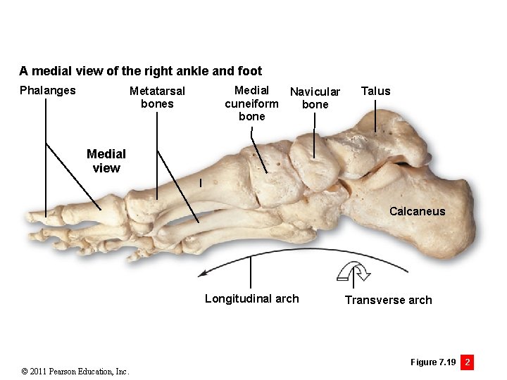A medial view of the right ankle and foot Phalanges Medial Navicular cuneiform bone