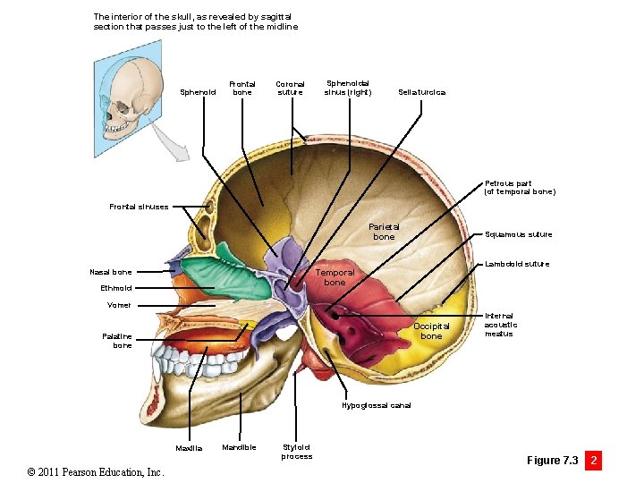 The interior of the skull, as revealed by sagittal section that passes just to