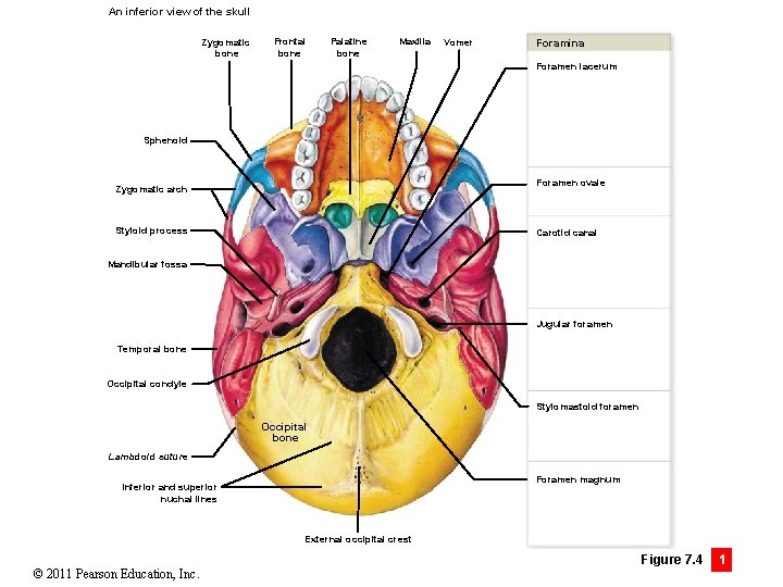 An inferior view of the skull Zygomatic bone Frontal bone Palatine bone Maxilla Vomer
