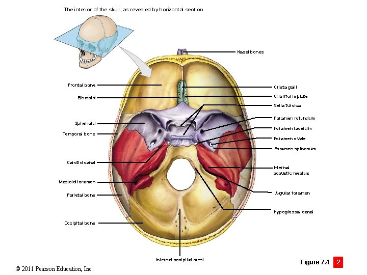 The interior of the skull, as revealed by horizontal section Nasal bones Frontal bone