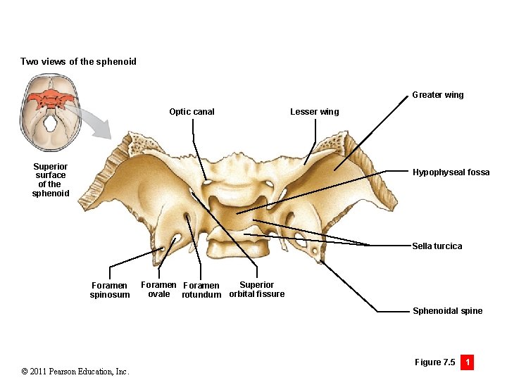Two views of the sphenoid Greater wing Optic canal Superior surface of the sphenoid