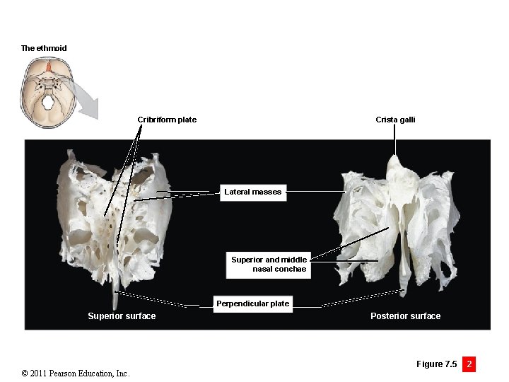 The ethmoid Cribriform plate Crista galli Lateral masses Superior and middle nasal conchae Perpendicular