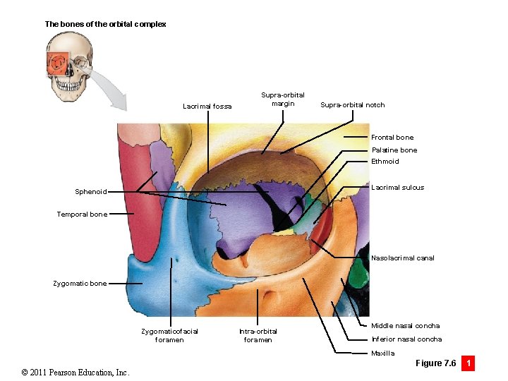 The bones of the orbital complex Lacrimal fossa Supra-orbital margin Supra-orbital notch Frontal bone