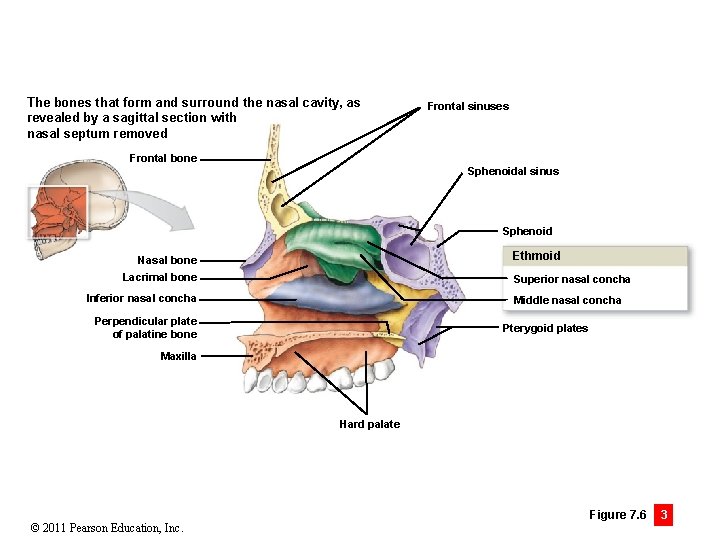 The bones that form and surround the nasal cavity, as revealed by a sagittal