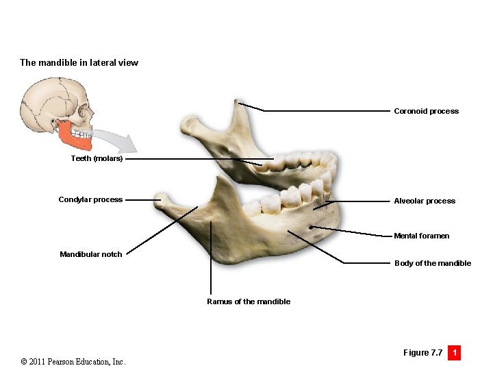 The mandible in lateral view Coronoid process Teeth (molars) Condylar process Alveolar process Mental
