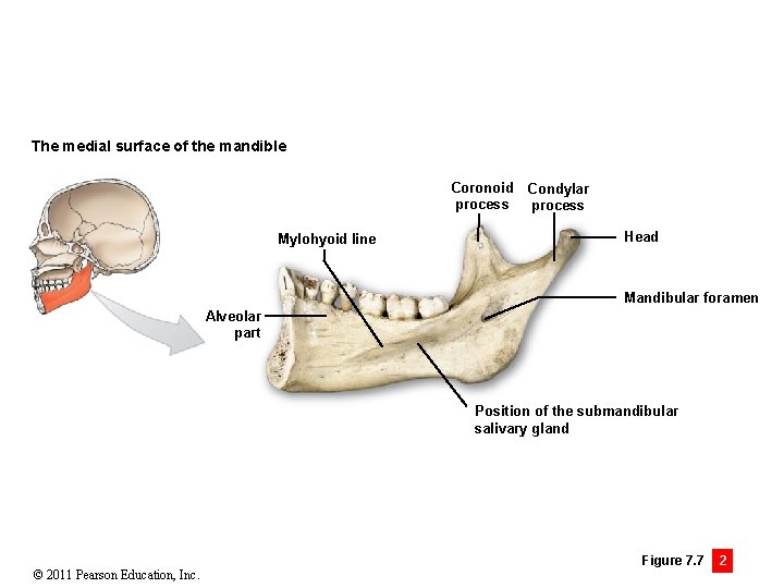 The medial surface of the mandible Coronoid Condylar process Mylohyoid line Head Mandibular foramen