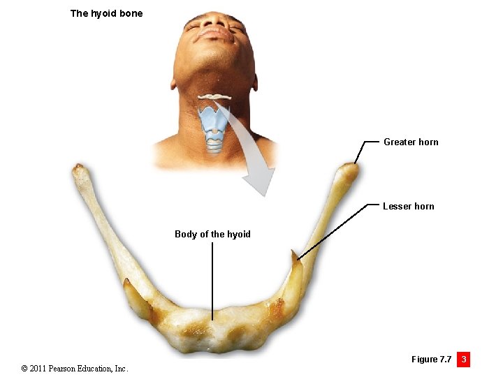 The hyoid bone Greater horn Lesser horn Body of the hyoid © 2011 Pearson