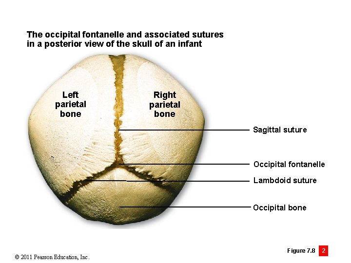 The occipital fontanelle and associated sutures in a posterior view of the skull of