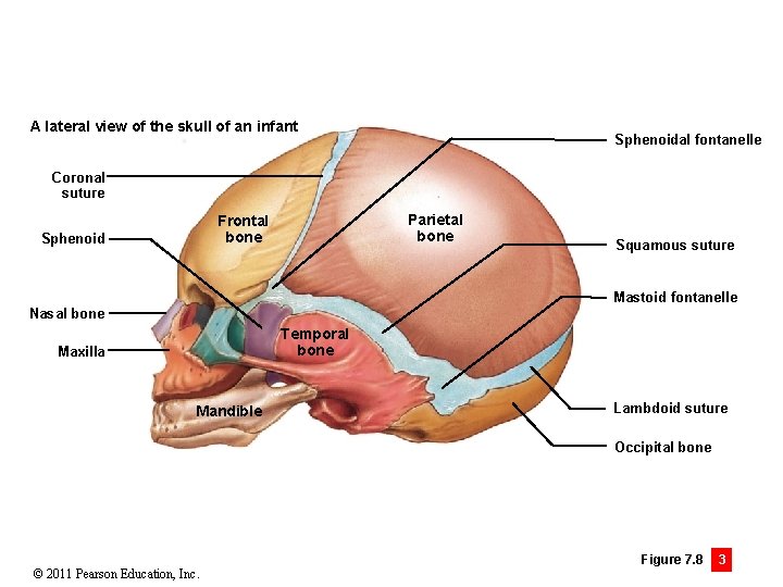 A lateral view of the skull of an infant Sphenoidal fontanelle Coronal suture Parietal