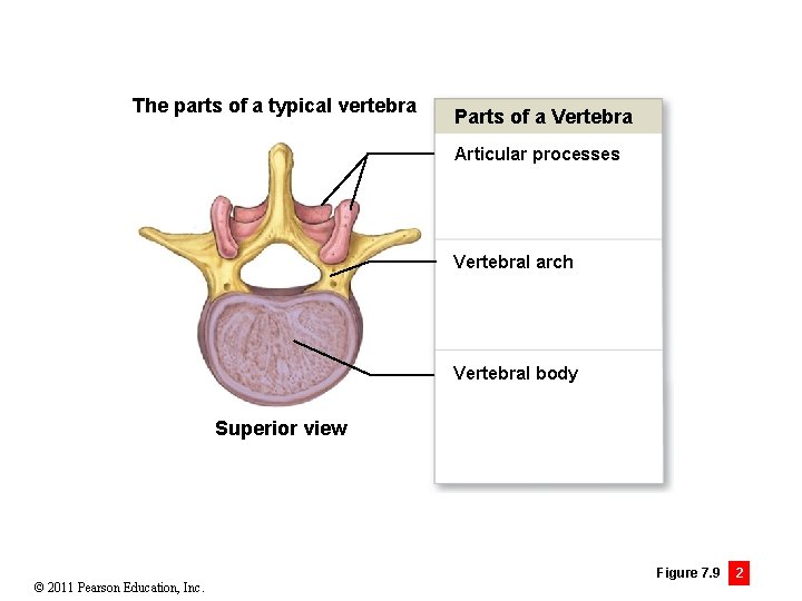 The parts of a typical vertebra Parts of a Vertebra Articular processes Vertebral arch