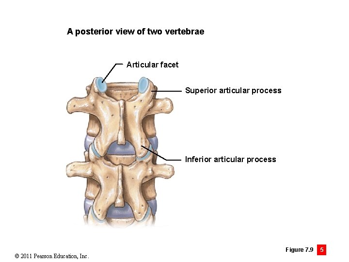 A posterior view of two vertebrae Articular facet Superior articular process Inferior articular process