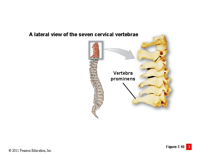 A lateral view of the seven cervical vertebrae Vertebra prominens © 2011 Pearson Education,
