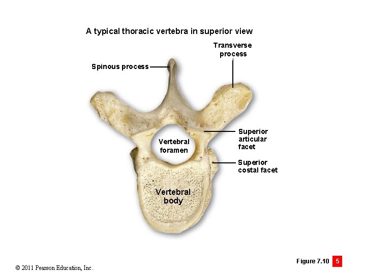 A typical thoracic vertebra in superior view Transverse process Spinous process Vertebral foramen Superior