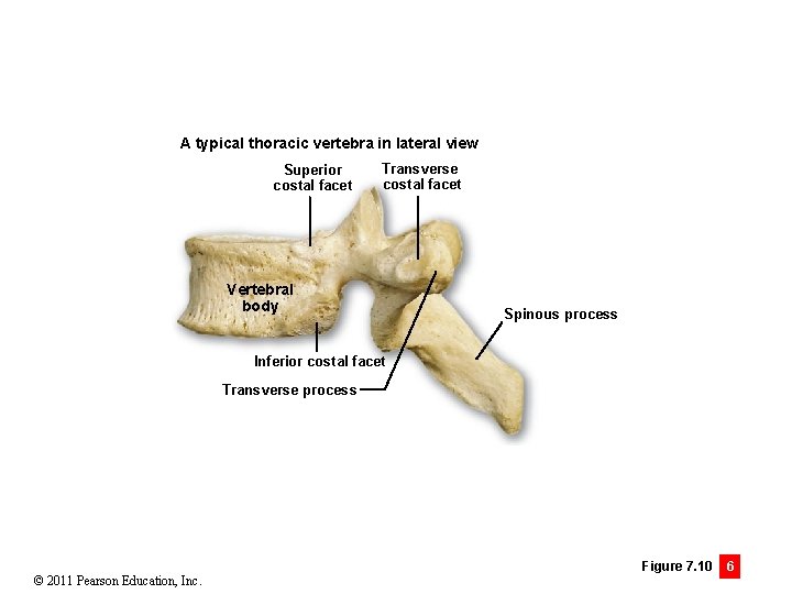 A typical thoracic vertebra in lateral view Superior costal facet Transverse costal facet Vertebral