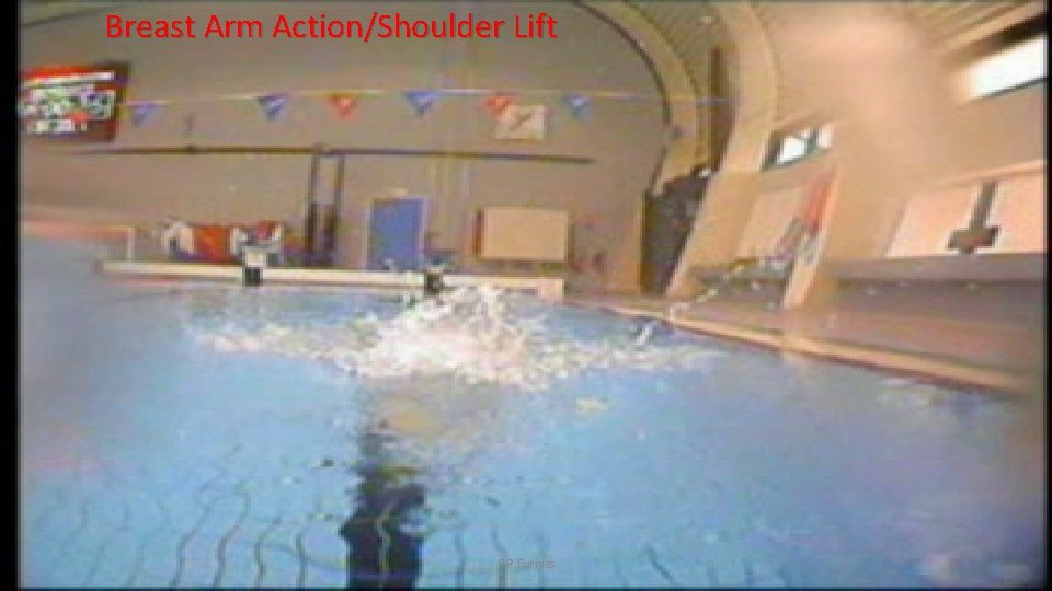 Breast Arm Action/Shoulder Lift F. P. Furniss 