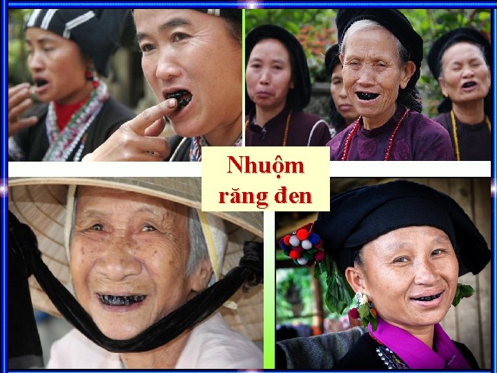 Nhuộm răng đen 