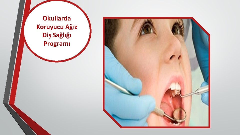 Okullarda Koruyucu Ağız Diş Sağlığı Programı 