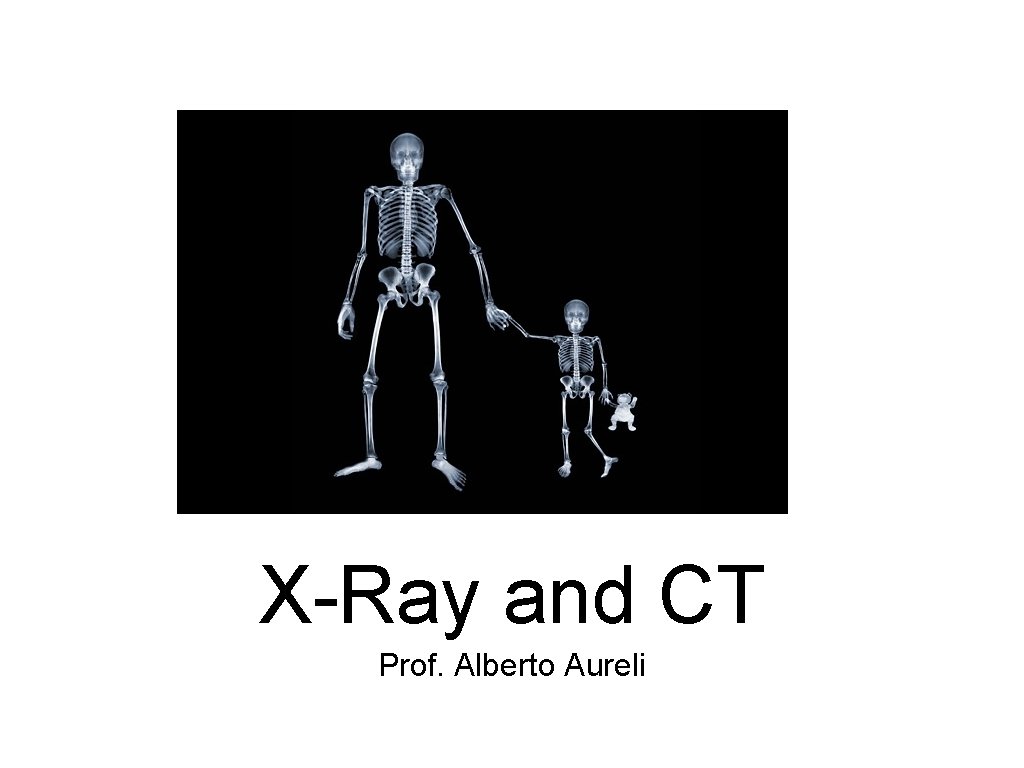 X-Ray and CT Prof. Alberto Aureli 