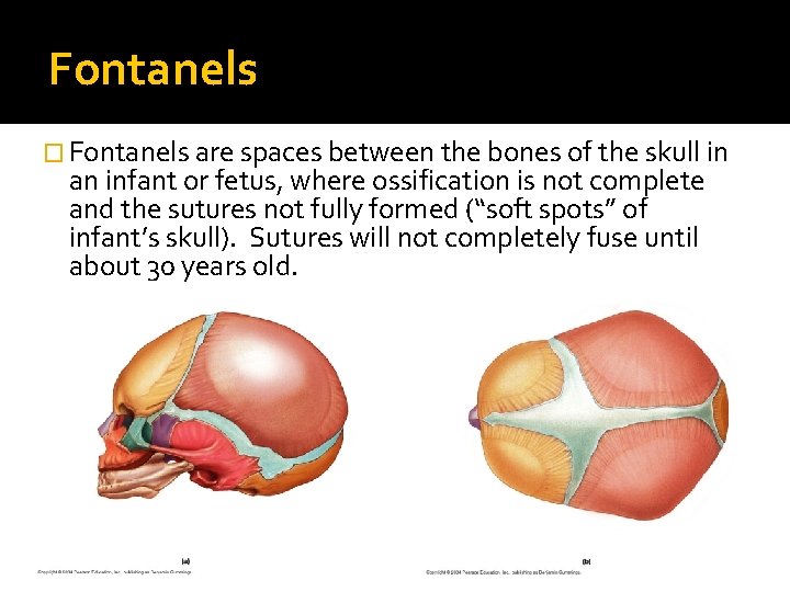 Fontanels � Fontanels are spaces between the bones of the skull in an infant