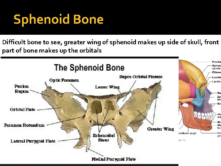 Sphenoid Bone Difficult bone to see, greater wing of sphenoid makes up side of