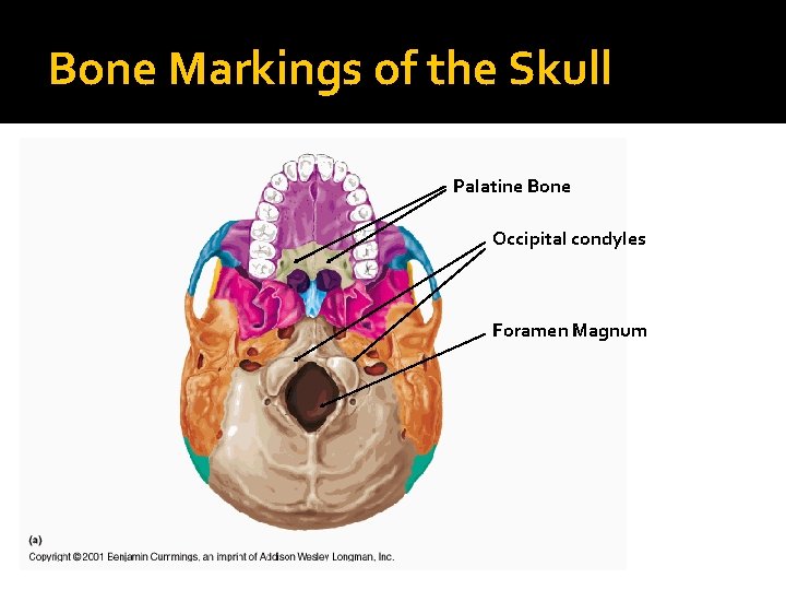 Bone Markings of the Skull Palatine Bone Occipital condyles Foramen Magnum 