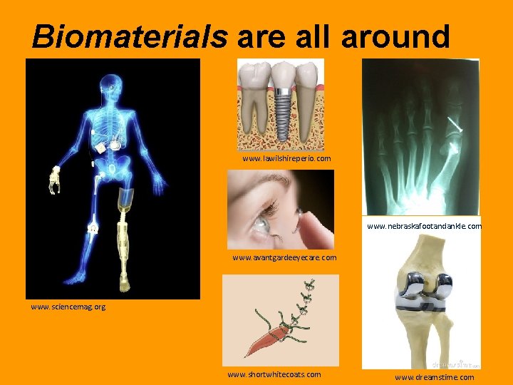 Biomaterials are all around www. lawilshireperio. com www. nebraskafootandankle. com www. avantgardeeyecare. com www.