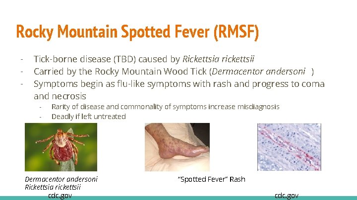 Rocky Mountain Spotted Fever (RMSF) - Tick-borne disease (TBD) caused by Rickettsia rickettsii Carried