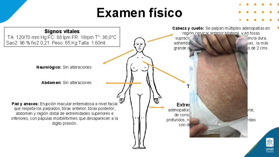 Examen físico Signos vitales TA: 120/70 mm Hg FC: 88 lpm FR: 18 rpm