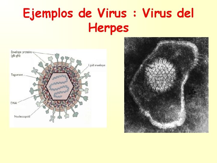 Ejemplos de Virus : Virus del Herpes 