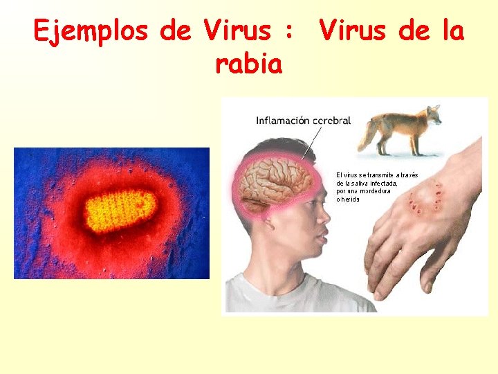 Ejemplos de Virus : Virus de la rabia 