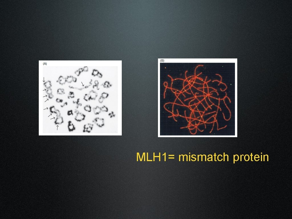 MLH 1= mismatch protein 