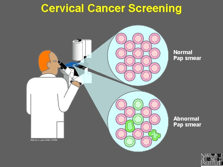 Cervical Cancer Screening Normal Pap smear Abnormal Pap smear 