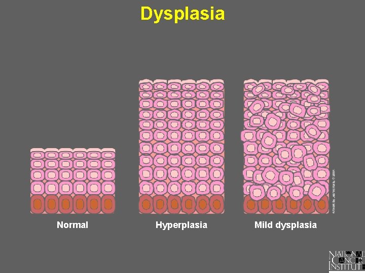 3-1-3-when-cells-lose-control-understanding