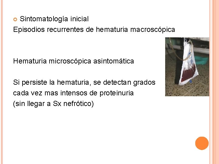 Sintomatología inicial Episodios recurrentes de hematuria macroscópica Hematuria microscópica asintomática Si persiste la hematuria,