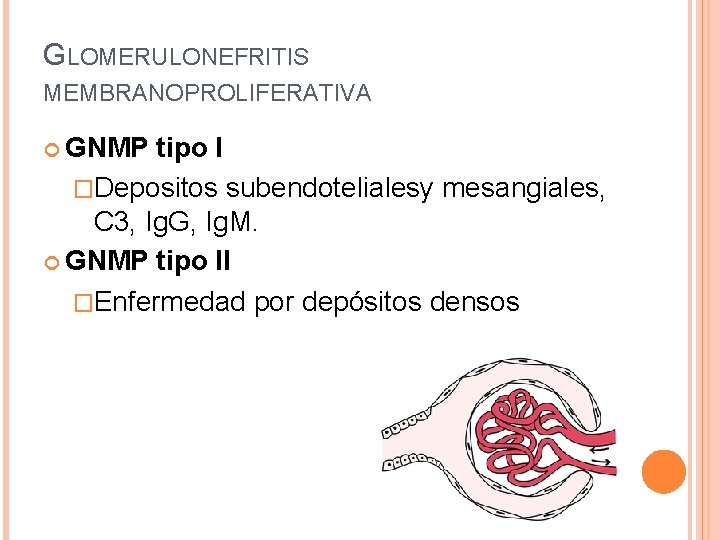 GLOMERULONEFRITIS MEMBRANOPROLIFERATIVA GNMP tipo I �Depositos subendotelialesy mesangiales, C 3, Ig. G, Ig. M.